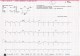 Initial ECG