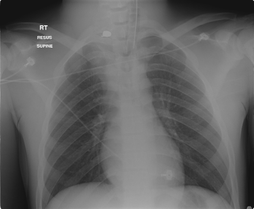 CXR