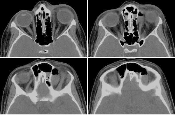 CT scan (illustrative)