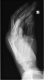 X-ray Lateral Left Hand