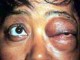 Clinical appearance